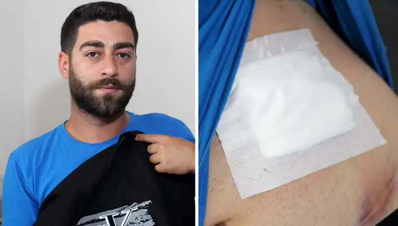 Karnında Ağrı Hissetti, Röntgende Şaşırtan Gerçek Ortaya Çıktı!
