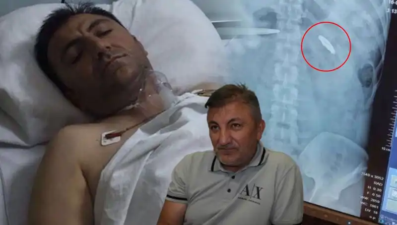15 Temmuz Gecesi: Vücudunda Kurşunla Yaşayan Kahramanın Hikayesi