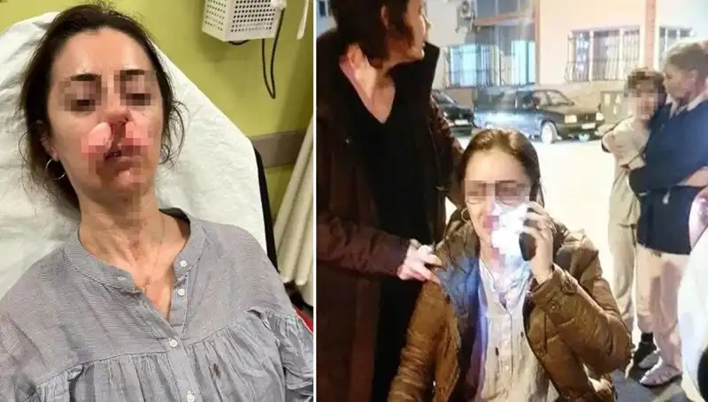 Eşinin Sevgilisi Sanarak Otomobil Kapısıyla Saldırdı!