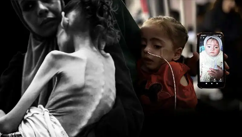 Meryem'in Dramı: 25 Kilodan 10 Kiloya Düştü, Bir Hayat Mücadelesi